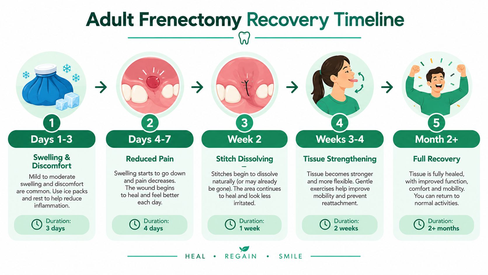 A five-step infographic showing the adult frenectomy recovery timeline from initial swelling to full healing.