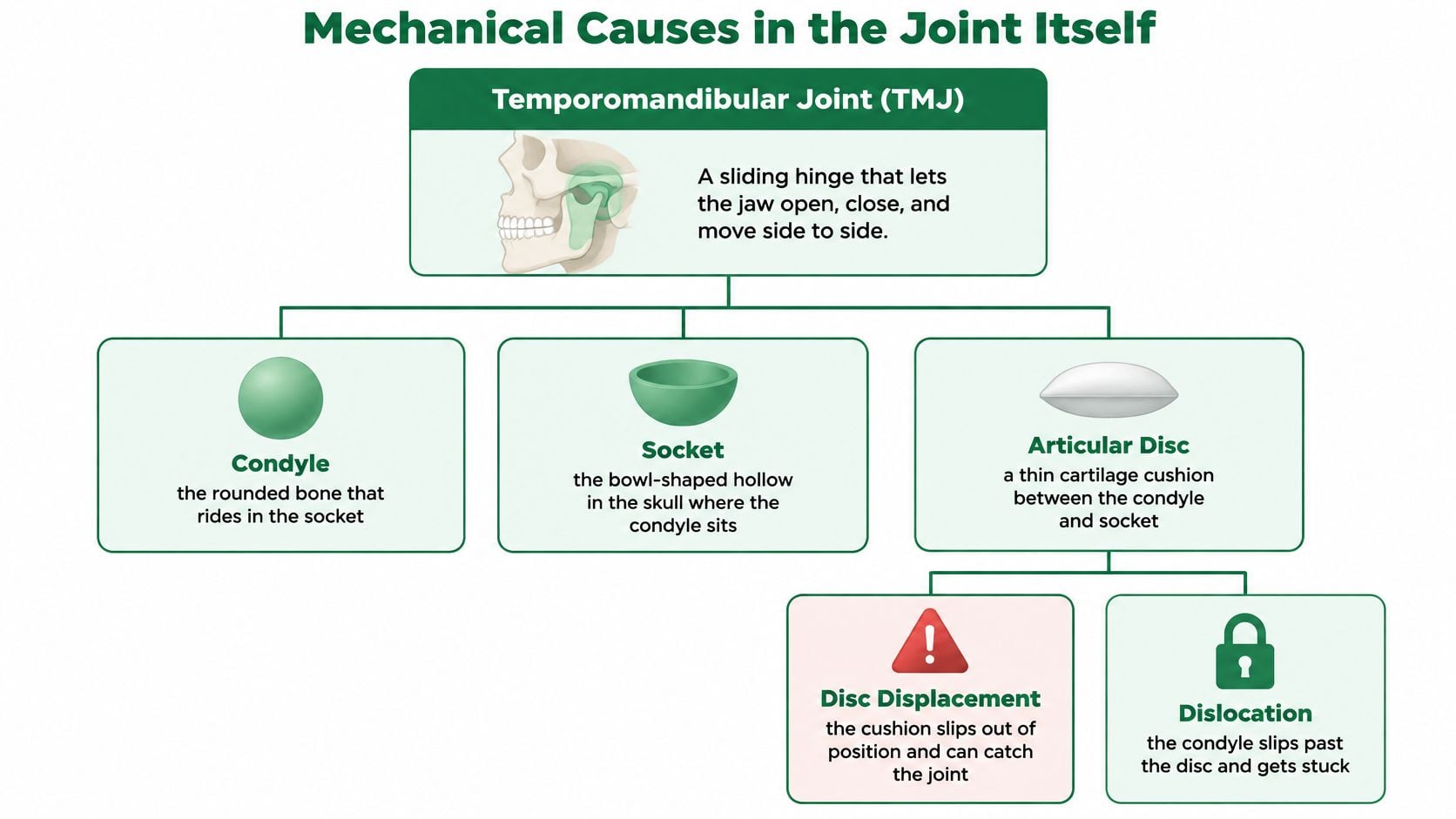 A diagram illustrating the anatomy of the temporomandibular joint and mechanical causes of jaw dysfunction.